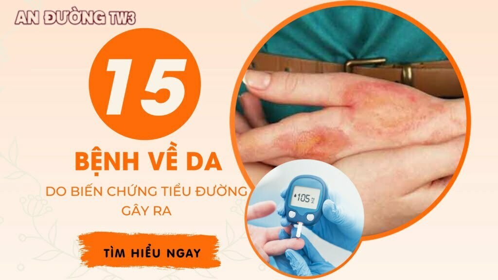 15 bệnh về da